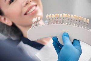 A dentist shows his patient dental veneers in TX