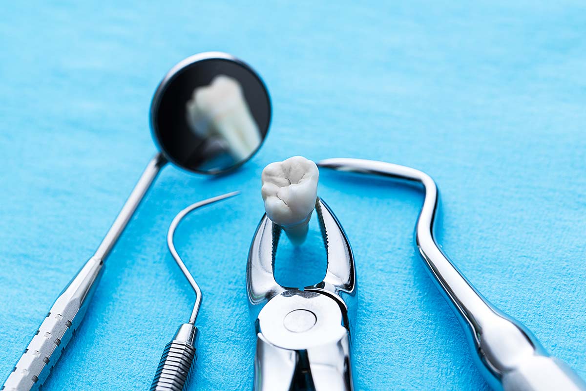 Wisdom Teeth Extraction Process Oral Surgery TX