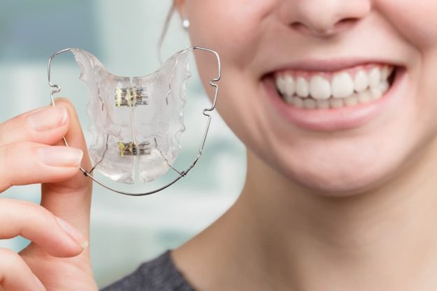 metal retainers