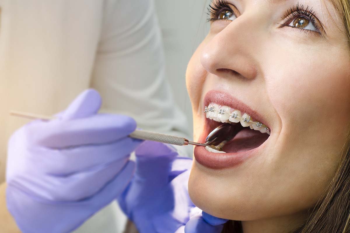 a woman is happy to receive adult orthodontics