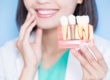 woman gets dental implants