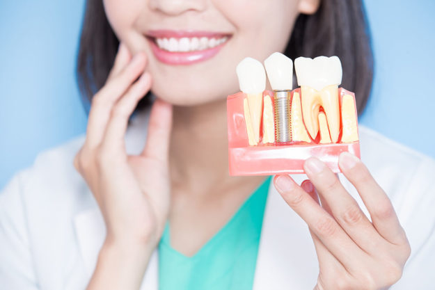 4 Benefits of Dental Implants (2) woman gets dental implants