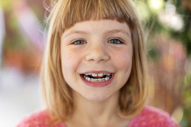 3 Benefits of Braces for Kids this little girl benefits from braces for kids