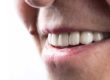 a man smiles with his dental implants
