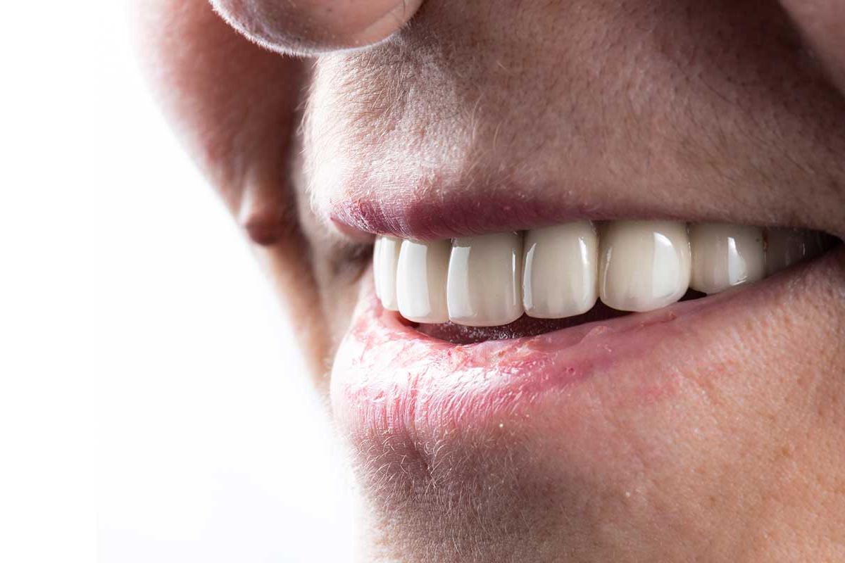 How Do Dental Implants Work a man smiles with his dental implants